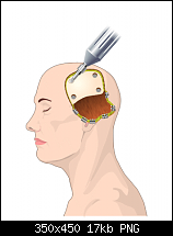 Click image for larger version. 

Name:	craniotomy.png 
Views:	382 
Size:	16.9 KB 
ID:	16281