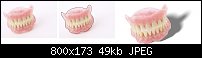 Click image for larger version. 

Name:	teeth.jpg 
Views:	650 
Size:	49.1 KB 
ID:	28971