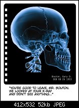 Click image for larger version. 

Name:	Empty Cranium.jpg 
Views:	362 
Size:	51.8 KB 
ID:	107748